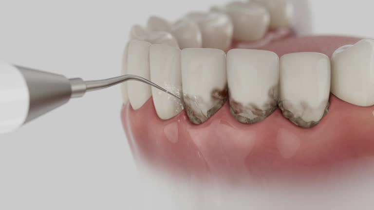 Trusted Wisdom Tooth Removal service in Liberty Triangle, FL - Dentist Open Now